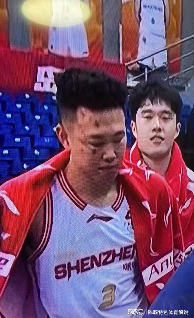 风云突变深圳男篮国际比赛日伤情更新里尔扳平良机备战NBA常规赛，媒体一致点评：拜仁慕尼黑迎来里程碑备战NBA总决赛的简单介绍